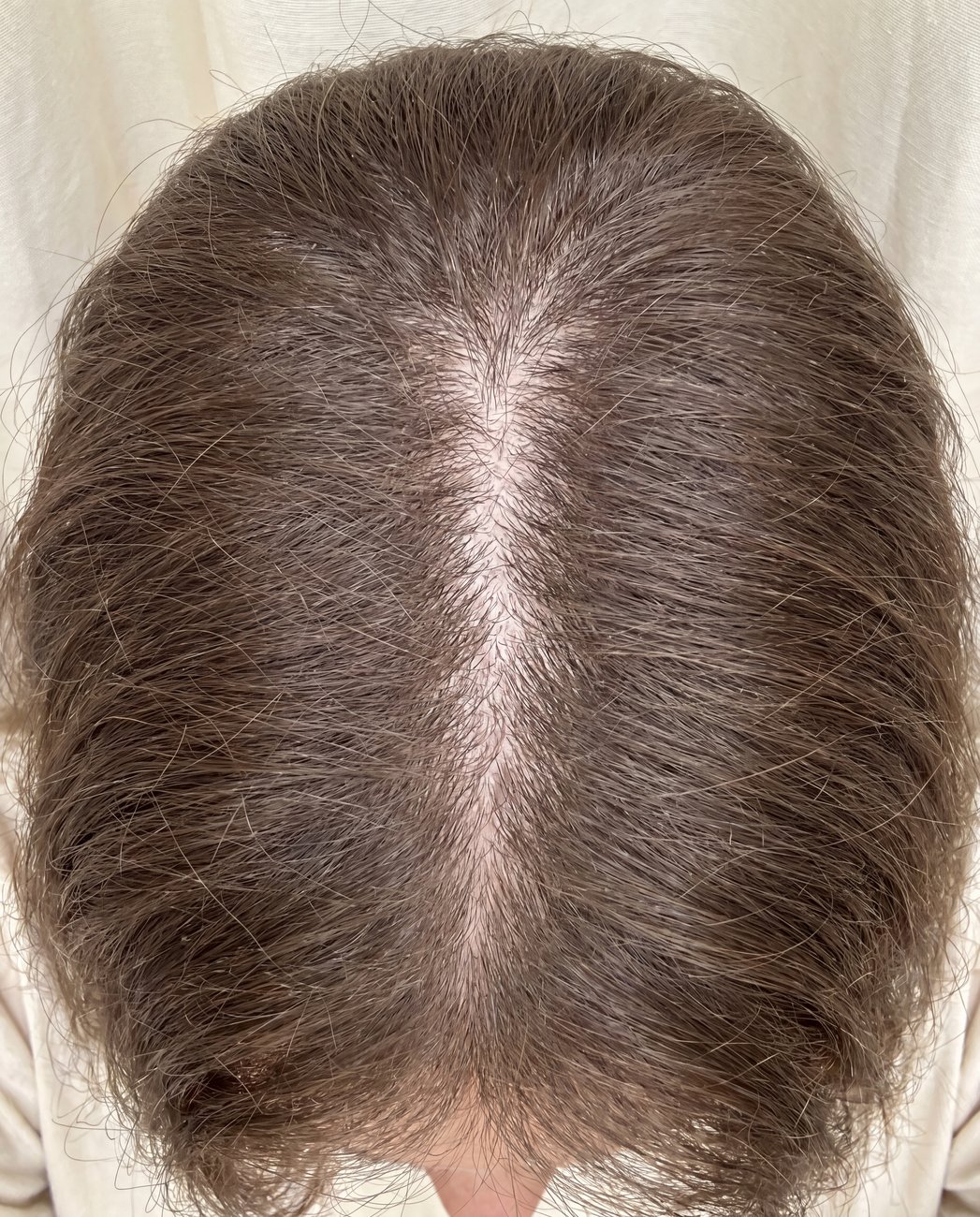 Visible widening of center part